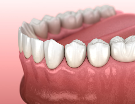 Render graphic of healthy gum and teeth from Brush & Floss Dental Center in Stratford, CT.