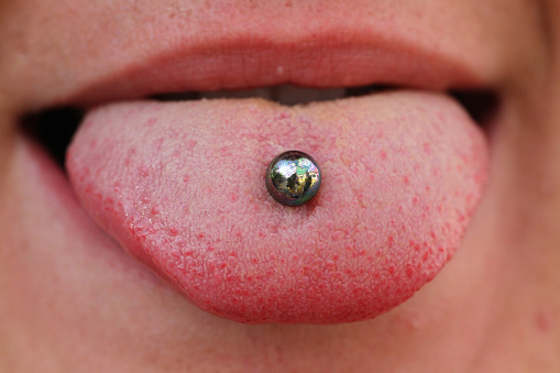 Photo of tongue piercing Brush & Floss Dental Center in Stratford, CT
