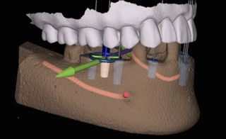 image of X Guide 4